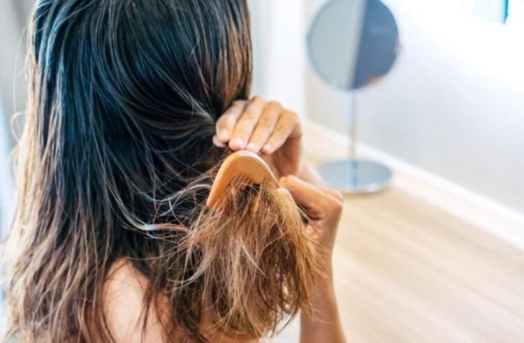 hair-loss-prevention-4-750x491-1