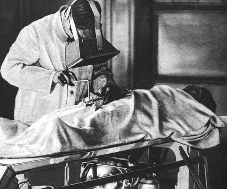 Source: Radiopaedia Source: Radiopaedia