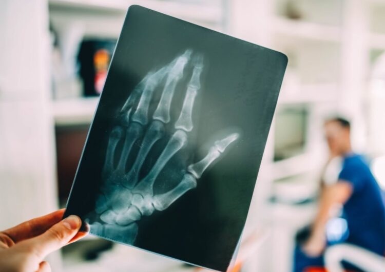 Source: professionalradiologyep.com Source: professionalradiologyep.com